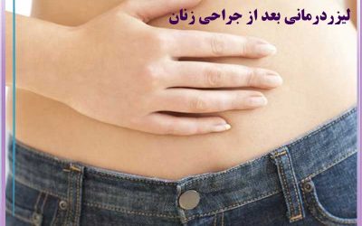 لیزر درمانی بعد از عمل جراحی در کرج | بهبود سریع‌تر و کاهش جای زخم