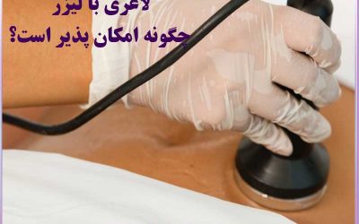 لاغری با لیزر در کرج | راهنمای کامل لیزر لیپولیز بدون جراحی