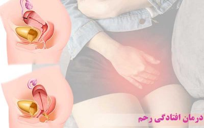 برای افتادگی رحم چه کاری می توانیم انجام دهیم؟