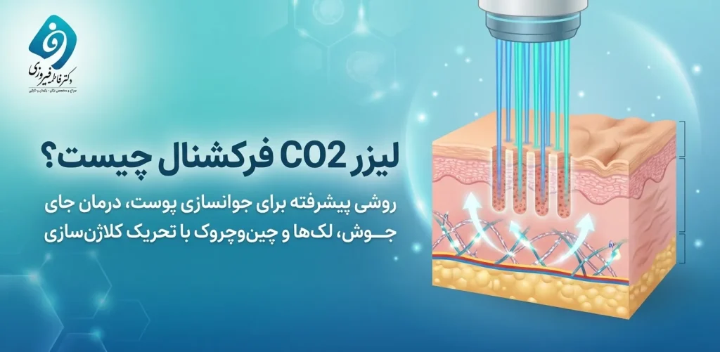لیزر CO2 فرکشنال چیست و در پزشکی چه کاربردی دارد؟ - دکتر فاطمه فیروزی