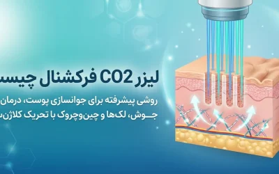 لیزر CO2 فرکشنال چیست و در پزشکی چه کاربردی دارد؟